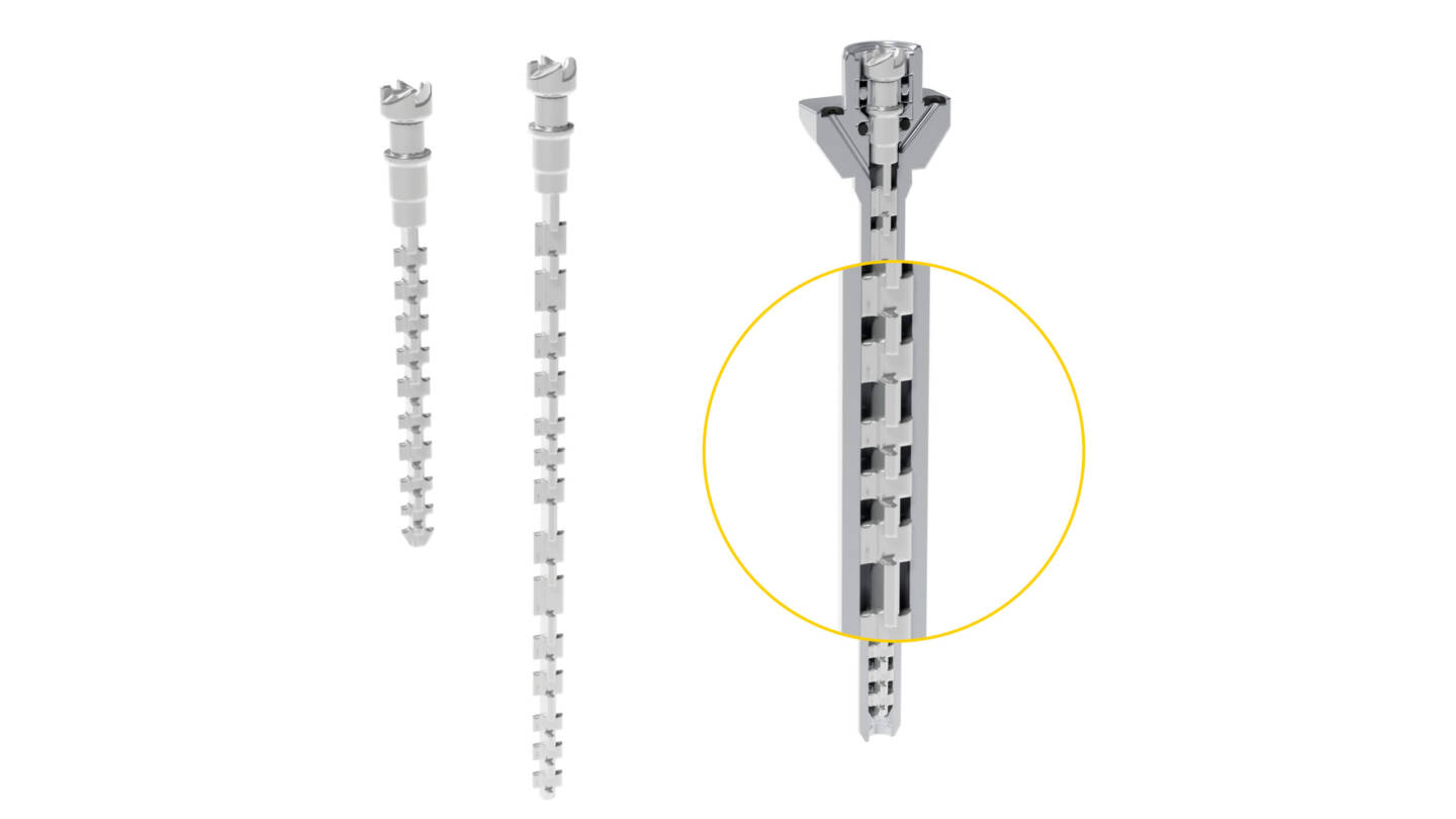 Dynamisches Mischen von 2K Materialien mir individuell gefertigten metallischen Mischwendeln.